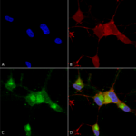SMC-314_Nav17_Antibody_N68-6_ICC-IF_Human_Neuroblastoma-cells-SH-SY5Y-Composite-1.png