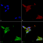 SMC-316_TrpM7_Antibody_S74_ICC-IF_Human_Neuroblastoma-cells-SH-SY5Y-Composite-1.png