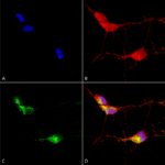 SMC-319_TrpV3_Antibody_N15-4_ICC-IF_Human_Neuroblastoma-cells-SH-SY5Y-Composite-1.png