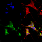 SMC-320_HCN4_Antibody_N114-10_ICC-IF_Human_Neuroblastoma-cells-SH-SY5Y-Composite-1.png