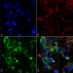 SMC-323_Slo2.2-Potassium-Channel_Antibody_N3-26_ICC-IF_Human_Neuroblastoma-cells-SH-SY5Y-Composite-1.png