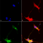SMC-327_SHANK-pan_Antibody_N23b-49_ICC-IF_Human_Neuroblastoma-cells-SH-SY5Y-Composite-1.png