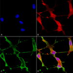 SMC-329_SHANK1_Antibody_N22-21_ICC-IF_Human_Neuroblastoma-cells-SH-SY5Y-Composite-1.png