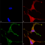SMC-332_Cav-beta-2_Antibody_N8b-1_ICC-IF_Human_Neuroblastoma-cells-SH-SY5Y-Composite-1.png