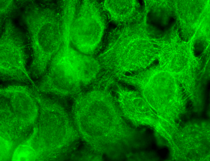 TRPV3 Antibody, Clone N15/39