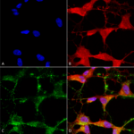 SMC-334_TrpV3_Antibody_N15-39_ICC-IF_Human_Neuroblastoma-cells-SH-SY5Y-Composite-1.png
