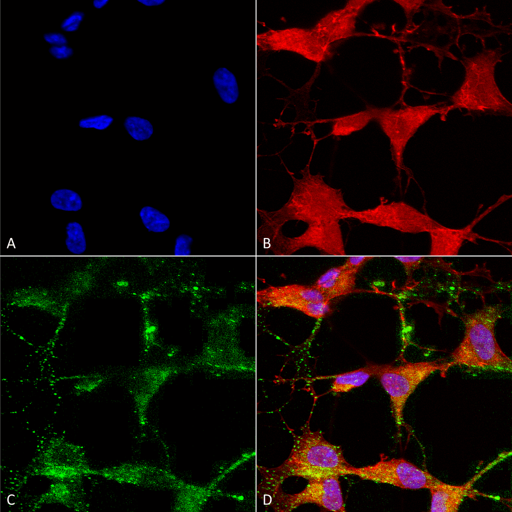 TRPV3 Antibody, Clone N15/39