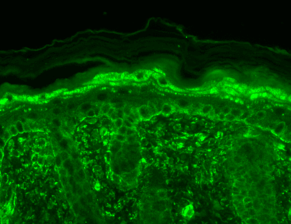 TRPV3 Antibody, Clone N15/39