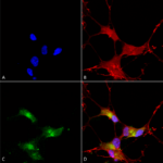 SMC-336_SHANK3_Antibody_S69_ICC-IF_Human_Neuroblastoma-cells-SH-SY5Y-Composite-1.png
