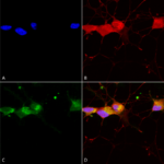 SMC-337_GluN2B-NR2B_Antibody_S59_ICC-IF_Human_Neuroblastoma-cells-SH-SY5Y-Composite-1.png