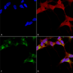 SMC-339_GABA-A-Receptor-Beta-3_Antibody_N87-25_ICC-IF_Human_Neuroblastoma-cells-SH-SY5Y-Composite-1.png