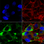 SMC-342_Nav1.8_Antibody_S134_ICC-IF_Human_Neuroblastoma-cells-SH-SY5Y-Composite-1.png