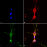 SMC-343_TrpC7_Antibody_N64A-36_ICC-IF_Human_Neuroblastoma-cells-SH-SY5Y-Composite-1.png