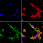 SMC-344_TrpC5_Antibody_N67-15_ICC-IF_Human_Neuroblastoma-cells-SH-SY5Y-Composite-1.png