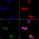 SMC-345_GABA-A-Receptor-Delta_Antibody_N151-3_ICC-IF_Human_Neuroblastoma-cells-SH-SY5Y-Composite-1.png