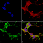 SMC-346_GABA-A-Receptor-Alpha-1_Antibody_N95-35_ICC-IF_Human_Neuroblastoma-cells-SH-SY5Y-Composite-1.png