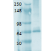 Mouse Anti-Sodium Iodide Symporter Antibody [14F] used in Western Blot (WB) on Human thyroid lysate (SMC-390)