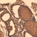 SMC-391_Sodium-Iodide-Symporter_Antibody_14F_IHC_Mouse_Thyroid_1.png