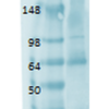 Mouse Anti-Sodium Iodide Symporter Antibody [14F] used in Western Blot (WB) on Human thyroid lysate (SMC-391)