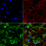 SMC-392_KCC2_Antibody_N1-12_ICC-IF_Human_Neuroblastoma-cells-SH-SY5Y-Composite-1.png