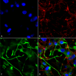 SMC-393_VAChT_Antibody_N6-38_ICC-IF_Human_Neuroblastoma-cells-SH-SY5Y-Composite-1.png