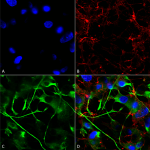 SMC-393_VAChT_Antibody_S6_ICC-IF_Human_Neuroblastoma-cells-SH-SY5Y-Composite-1.png