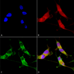 SMC-395_VGLUT2_Antibody_N29-29_ICC-IF_Human_Neuroblastoma-cells-SH-SY5Y-Composite-1.png