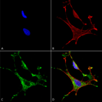 SMC-396_MMP9_Antibody_L51-82_ICC-IF_Human_Neuroblastoma-cells-SH-SY5Y-Composite-1.png
