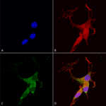 SMC-397_VGLUT3_Antibody_N34-34_ICC-IF_Human_Neuroblastoma-cells-SH-SY5Y-Composite-1.png
