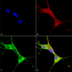 SMC-398_Copper-Transporting-ATPase-1_Antibody_L60-4_ICC-IF_Human_Neuroblastoma-cells-SH-SY5Y-Composite-1.png