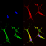 SMC-399_Copper-Transporting-ATPase-2_Antibody_L62-29_ICC-IF_Human_Neuroblastoma-cells-SH-SY5Y-Composite-1.png