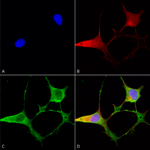 SMC-400_Ankyrin-B_Antibody_N105-13_ICC-IF_Human_Neuroblastoma-cells-SH-SY5Y-Composite-1.png