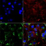 SMC-401_SNAT1_Antibody_N104-32_ICC-IF_Human_Neuroblastoma-cells-SH-SY5Y-Composite-1.png