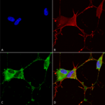 SMC-402_GABA-B-Receptor-2_Antibody_N81-2_ICC-IF_Human_Neuroblastoma-cells-SH-SY5Y-Composite-1.png