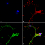 SMC-403_GABA-B-Receptor-1_Antibody_N93A-49_ICC-IF_Human_Neuroblastoma-cells-SH-SY5Y-Composite-1.png