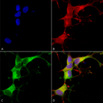 SMC-404_Ankyrin-G_Antibody_N106-20_ICC-IF_Human_Neuroblastoma-cells-SH-SY5Y-Composite-1.png