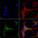 SMC-405_Cav3.1_Antibody_N178A-9_ICC-IF_Human_Neuroblastoma-cells-SH-SY5Y-Composite-1.png