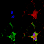 SMC-406_EAAC1_Antibody_N180-41_ICC-IF_Human_Neuroblastoma-cells-SH-SY5Y-Composite-1.png