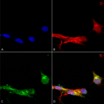 SMC-407_mGluR1-5_Antibody_N75-33_ICC-IF_Human_Neuroblastoma-cells-SH-SY5Y-Composite-1.png