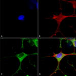 SMC-408_Clcn3_Antibody_N258-5_ICC-IF_Human_Neuroblastoma-cells-SH-SY5Y-Composite-1.png