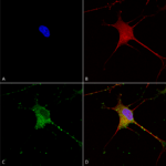 SMC-409_SUR1_Antibody_N289-16_ICC-IF_Human_Neuroblastoma-cells-SH-SY5Y-Composite-1.png