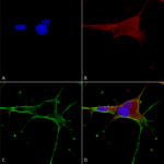 SMC-410_GluN1-NR1_Antibody_N308-48_ICC-IF_Human_Neuroblastoma-cells-SH-SY5Y-Composite-1.png