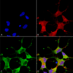 SMC-413_GIT1_Antibody_N39B-8_ICC-IF_Human_Neuroblastoma-cells-SH-SY5Y-Composite-1.png