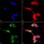SMC-417_NALCN_Antibody_N187-7_ICC-IF_Human_Neuroblastoma-cells-SH-SY5Y-Composite-1.png