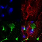 SMC-418_LRP4-Extracellular_Antibody_N207-27_ICC-IF_Human_Neuroblastoma-cells-SH-SY5Y-Composite-1.png