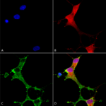 SMC-419_mGluR1-5_Antibody_N75-3_ICC-IF_Human_Neuroblastoma-cells-SH-SY5Y-Composite-1.png
