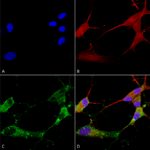 SMC-422_TARP-Gamma2-4-8-Stargazin_Antibody_N245-36_ICC-IF_Human_Neuroblastoma-cells-SH-SY5Y-Composite-1.png