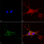 SMC-424_Synaptotagmin-7_Antibody_N275-14_ICC-IF_Human_Neuroblastoma-cells-SH-SY5Y-Composite-1.png