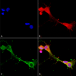 SMC-427_ASIC1_Antibody_N271-44_ICC-IF_Human_Neuroblastoma-cells-SH-SY5Y-Composite-1.png