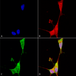 SMC-428_Brevican_Antibody_N294A-6_ICC-IF_Human_Neuroblastoma-cells-SH-SY5Y-Composite-1.png